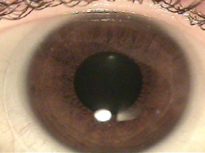 Iris image